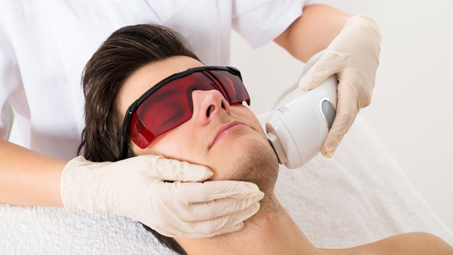 Laser Hair Removal: Painless Perfection for Smooth Skin