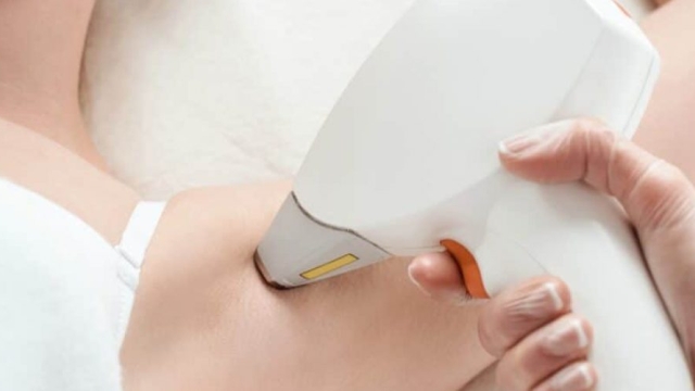 Smooth and Silky: Unveiling the Magic of Laser Hair Removal